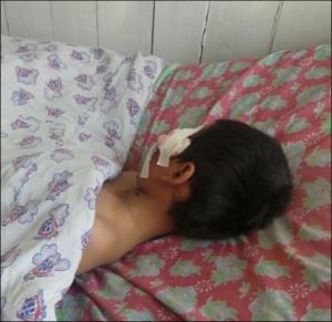 Один из детей, пострадавших в с. Зардалы